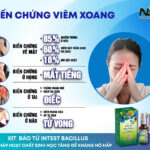 Biến Chứng Viêm Xoang