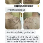 Review Diệp Lục Th Health Hỗ Trợ Bệnh Tự Miễn Da Liễu