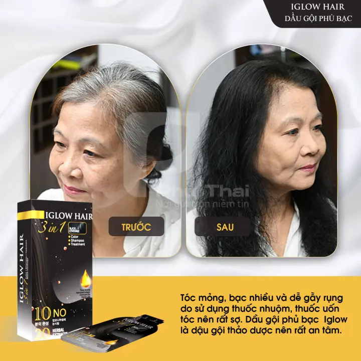 feedback iglow hair - review iglow hair - iglow hair có tốt không - iglow hair có hiệu quả không - Dropbiz - 11