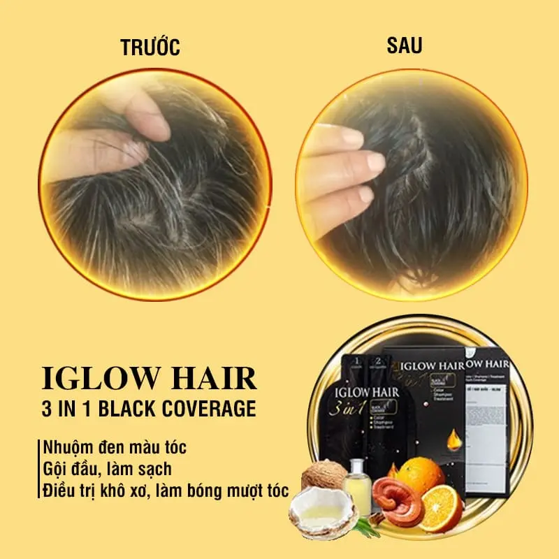 feedback iglow hair - review iglow hair - iglow hair có tốt không - iglow hair có hiệu quả không - Dropbiz - 2