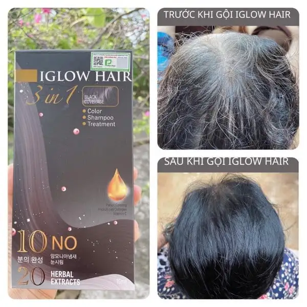 feedback iglow hair - review iglow hair - iglow hair có tốt không - iglow hair có hiệu quả không - Dropbiz - 3