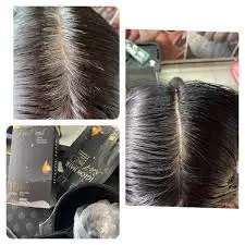 feedback iglow hair - review iglow hair - iglow hair có tốt không - iglow hair có hiệu quả không - Dropbiz - 4