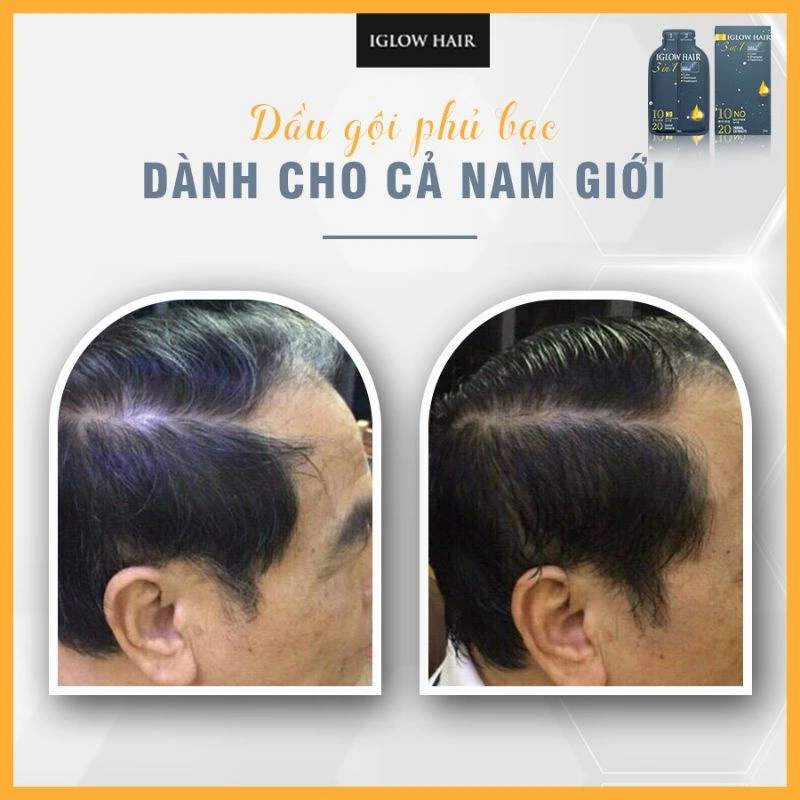 feedback iglow hair - review iglow hair - iglow hair có tốt không - iglow hair có hiệu quả không - Dropbiz - 8