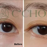 Review Tinh Chất Dưỡng Mắt 3 Tác động C’choi - Triple Effect Eye Serum