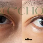 Review Tinh Chất Dưỡng Mắt C’choi - Triple Effect Eye Serum