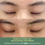 Review Dưỡng Mi Tế Bào Gốc C'choi - Bio-placenta Lash Serum - Punar - Dropbiz - Hình 13