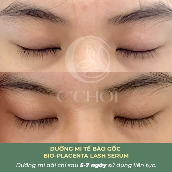 Review Dưỡng Mi Tế Bào Gốc C'choi - Bio-placenta Lash Serum - Punar - Dropbiz - Hình 13