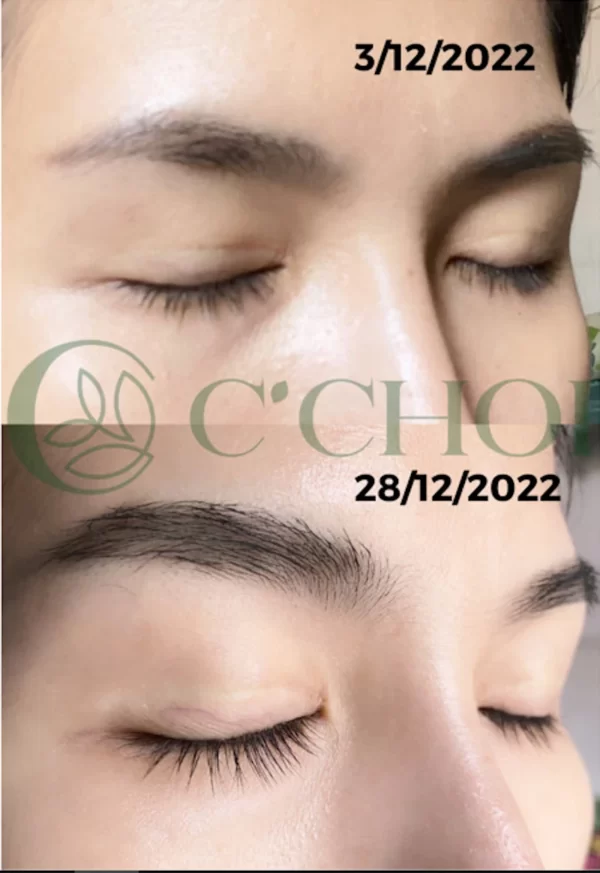 Review Dưỡng Mi Tế Bào Gốc C'choi - Bio-placenta Lash Serum - Punar - Dropbiz - Hình 3