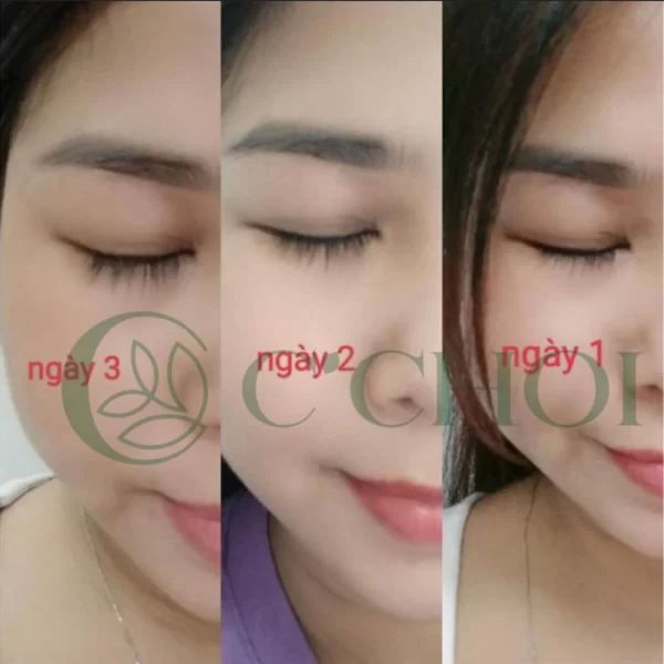 Review Dưỡng Mi Tế Bào Gốc C'choi - Bio-placenta Lash Serum - Punar - Dropbiz - Hình 5