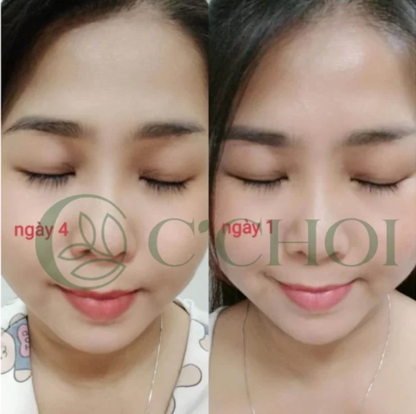 Review Dưỡng Mi Tế Bào Gốc C'choi - Bio-placenta Lash Serum - Punar - Dropbiz - Hình 7